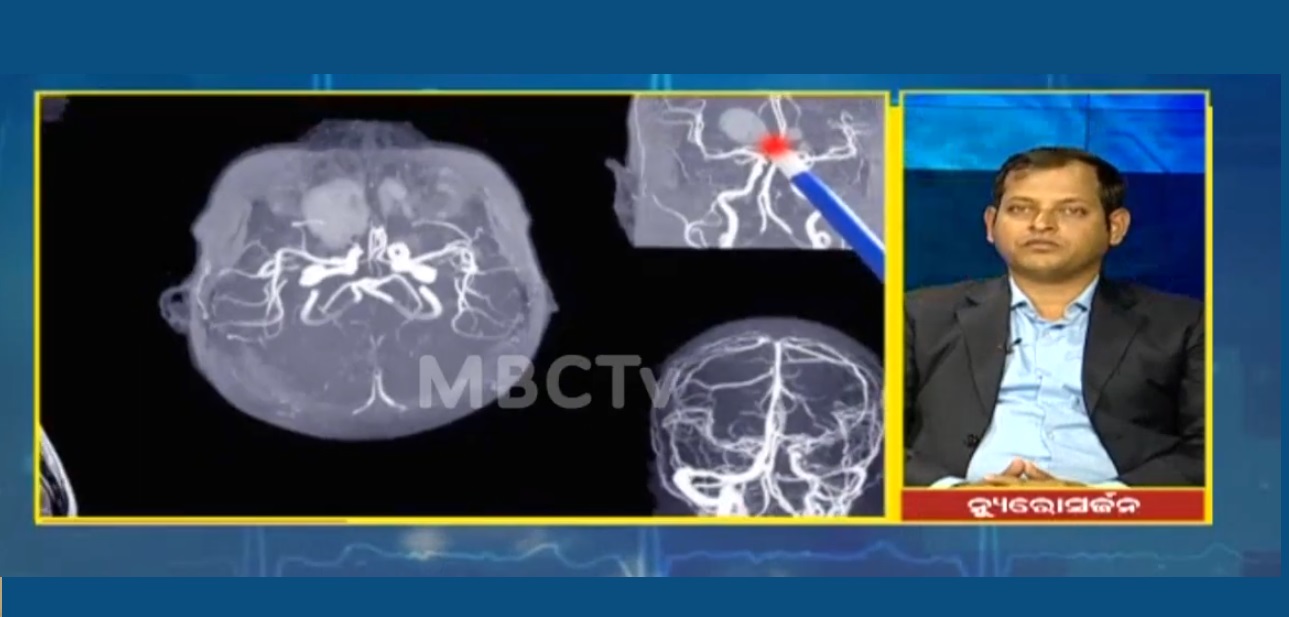 Brain Aneurysm || Neurosurgeon Dr Bimal Sahoo 